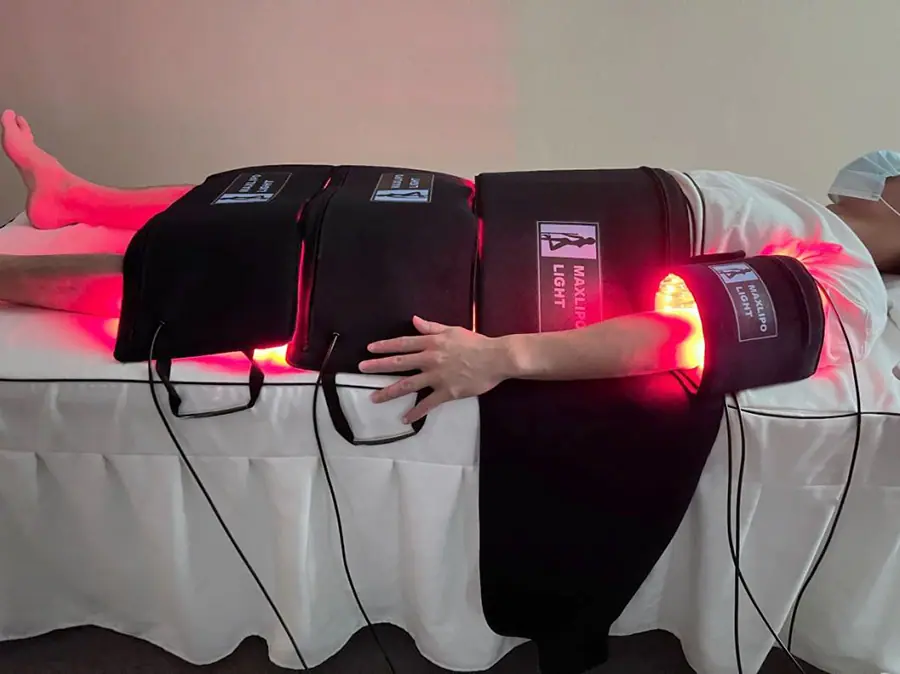 Lipo Laser